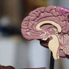 Brain wellness model
